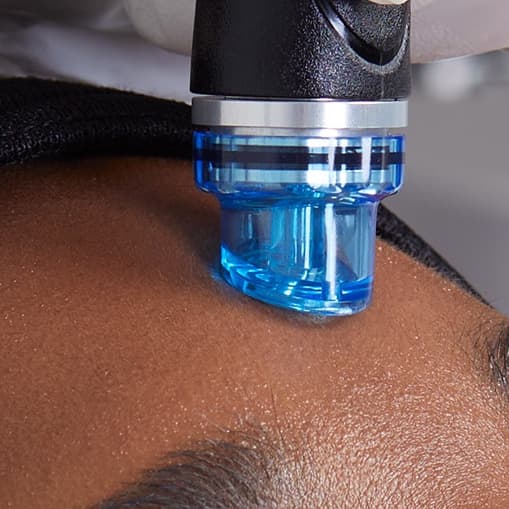 Express HydraFacial at Hydro Glow Facial in Brea, CA